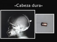 CABEZA DURA (Residencia de Diagnostico por imagenes. HIGA Dr. Oscar Alende, Mar del plata.)