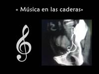 MUSICA EN LAS CADERAS (Julieta Ramos Pacheco, Juan Said Galán. HIGA Dr. Oscar Alende, Mar del plata.)